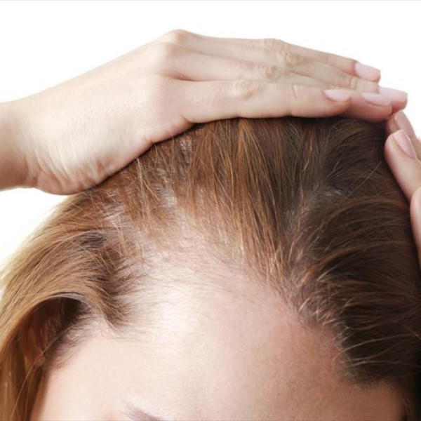 does estradiol cause hair loss