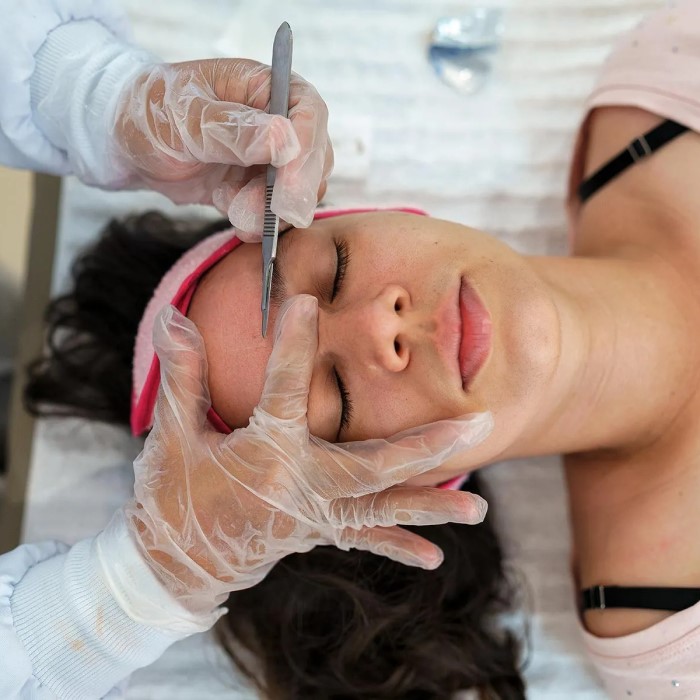 is dermaplaning good for your skin