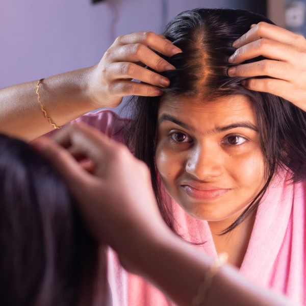 does estradiol cause hair loss