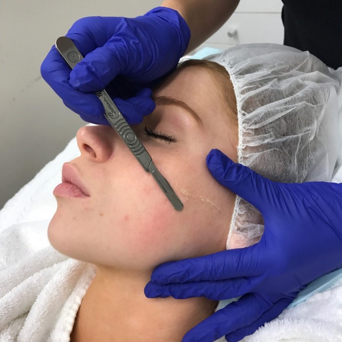 is dermaplaning good for your skin