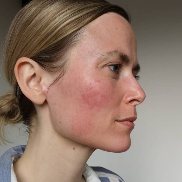 skin care for sensitive skin