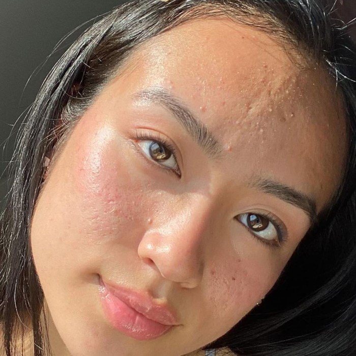 skin care for sensitive skin