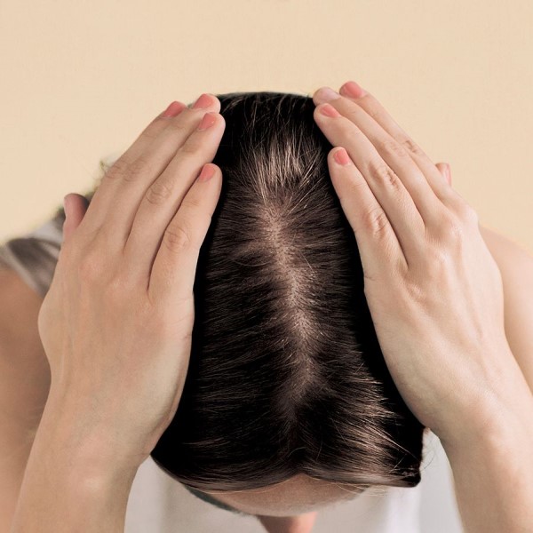does dandruff shampoo cause hair loss