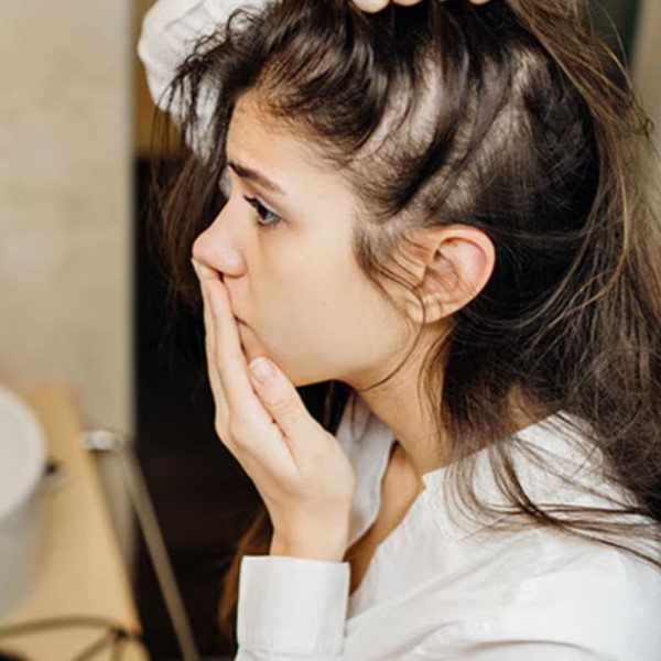 does sertraline cause hair