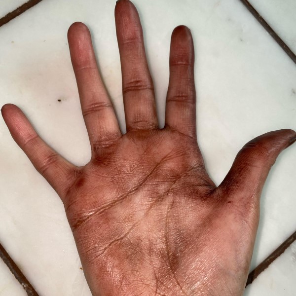 how to get hair dye off skin