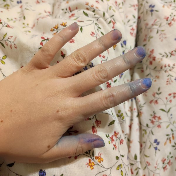 how to get hair dye off skin