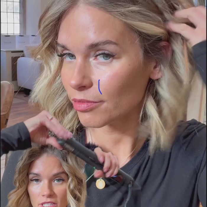 does perimenopause cause hair loss