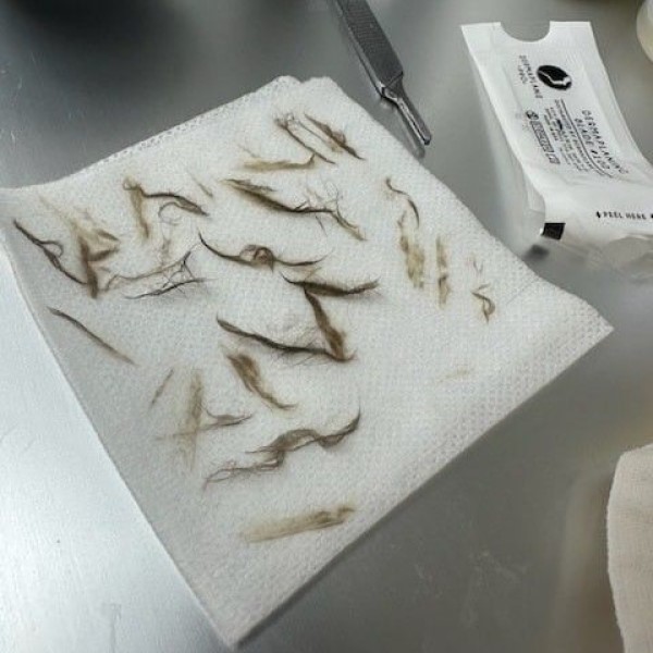 dermaplaning at home